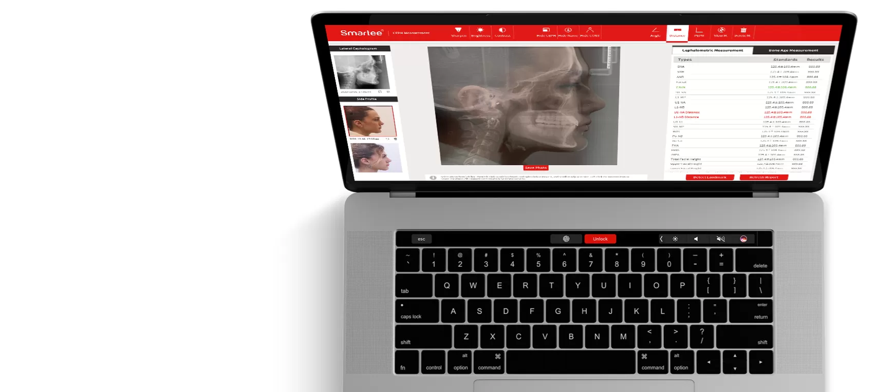 Smartee數位化工具