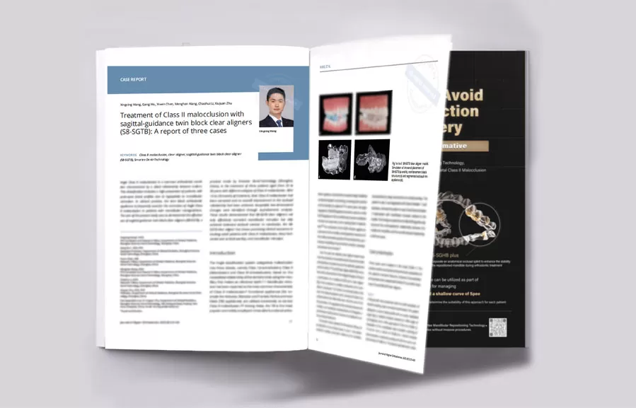 adult-class-ii-malocclusion-cases-treated-with-smartee-s8-sgtb-published-in-jao1.jpg adult-class-ii-malocclusion-cases-treated-with-smartee-s8-sgtb-published-in-jao1.jpg