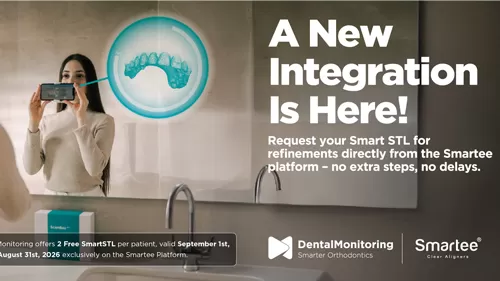 Smartee and Dental Monitoring Partner to Simplify Refinement Workflows for Orthodontists